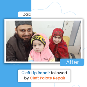 ZAID-after